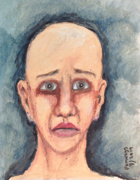 Sad bald woman