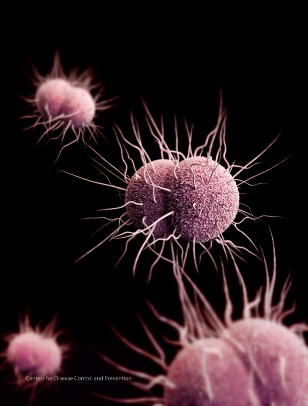Gonorrhea bacterium
